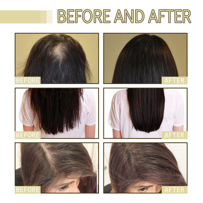 JISKG 180 ml EELHOE Rosemary Hair Growth Oil – 3-Pack for Dry & Damaged Hair