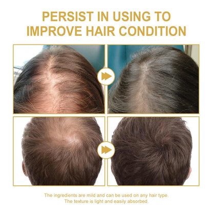 JISKG 180 ml EELHOE Rosemary Hair Growth Oil – 3-Pack for Dry & Damaged Hair