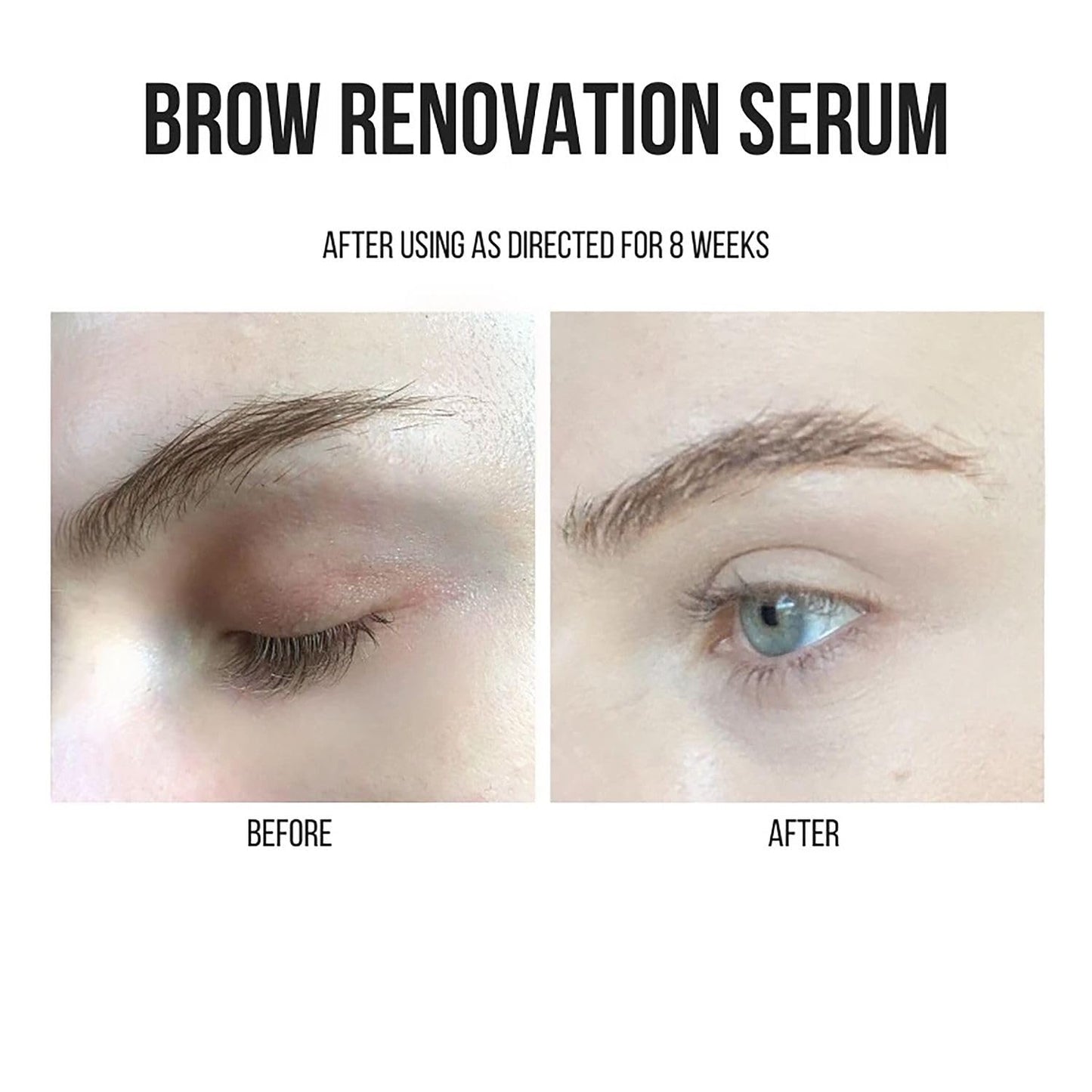 Joey Healy Brow Renovation Serum – Fuller Brows, Paraben-Free, Vitamin-Powered