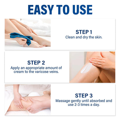 Josera Varicose Veins Cream for Legs – Soothing Relief & Smoother Skin (2 x 20 g)