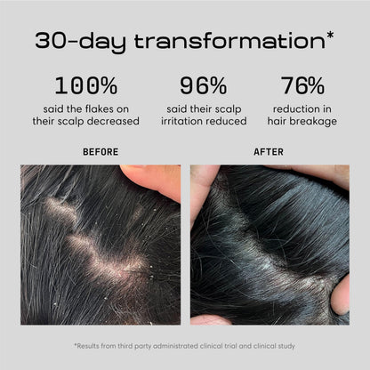 Jupiter Anti Dandruff Shampoo — Balance Scalp & Reduce Flakes (Sulfate-Free)