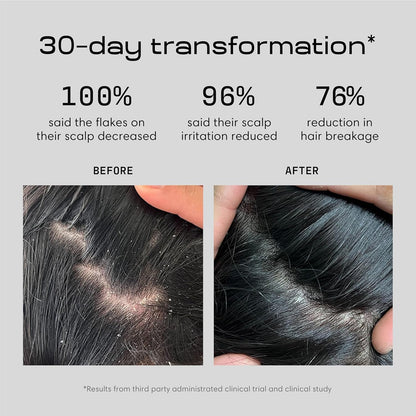 Jupiter Scalp Solution Trio: Anti-Dandruff Shampoo, Conditioner & Serum