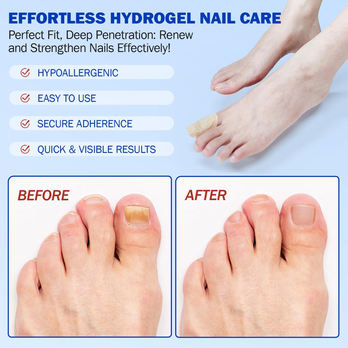 JWBVCTCR 21 PCS Nail Patches – Extra Strength 8-Hour Overnight Nail Repair