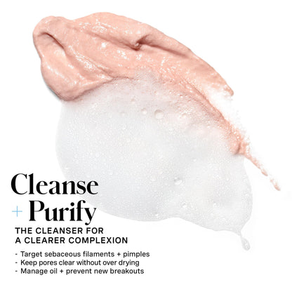 Kate Somerville EradiKate 3% Sulfur Daily Foaming Cleanser – Acne-Prone Skin, Pore Cleansing, 4 oz