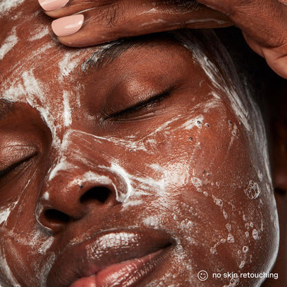 Kate Somerville ExfoliKate Cleanser: Daily Exfoliating Foaming Face Wash with Glycolic & Lactic Acids (8 oz)
