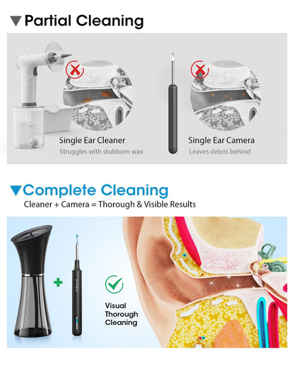 KAUGIC Ear Wax Removal Kit with Camera – Safe, Visual Ear Cleaning