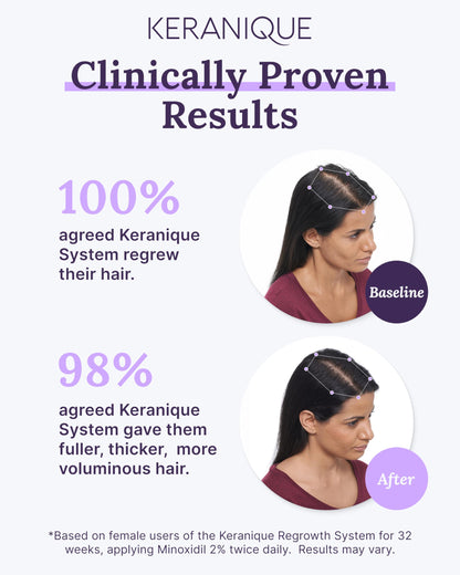Keranique 5% Minoxidil Foam for Women – Hair Regrowth, NutriGrow Hydration & 4-Month Supply