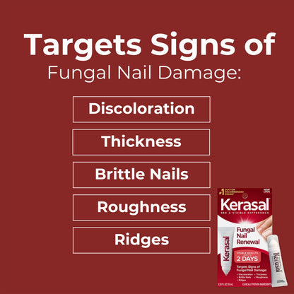 Kerasal Nail Fungus Extra Strength – Twin Pack Restorative Nail Repair (0.33 fl oz each)