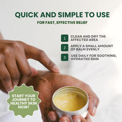 KESMEDIK Tea Tree Oil Balm for Skin – Soothes Itching & Rashes (2-Pack)