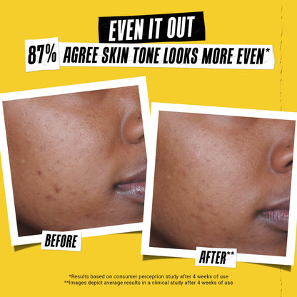 Kiehl's Better Screen UV Serum SPF 50+ — Invisible Facial Sunscreen with Collagen Peptide