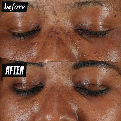 Kiehl's Clearly Corrective Dark Spot Serum | Brightening Facial Serum for Even Skin Tone
