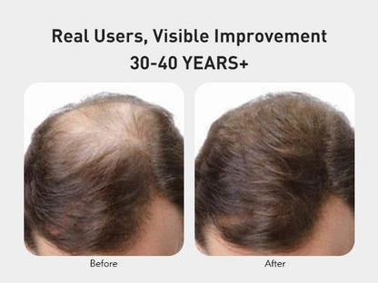 KINTOR 0.5% KX-826 Hair Regrowth Spray for Men – Plant-Based DHT Blocker, 60ml