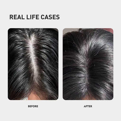 KINTOR 0.9% KX-826 DHT Blocker Hair Growth Foam 60ml Pro | For Men & Women
