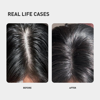 KINTOR 0.5% KX-826 Hair Growth Spray – DHT Blocker for Thicker Hair (60ml)