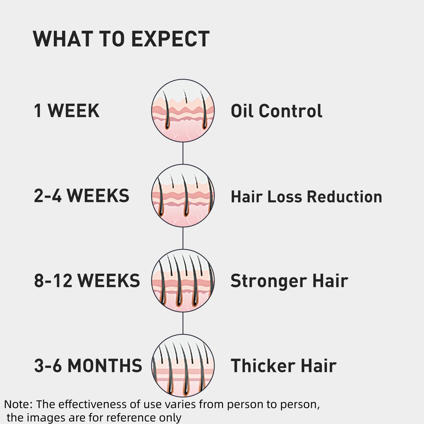 KINTOR 0.9% KX-826 Hair Regrowth Spray – Supports Healthy Hair Growth & Oil Control | 60ml