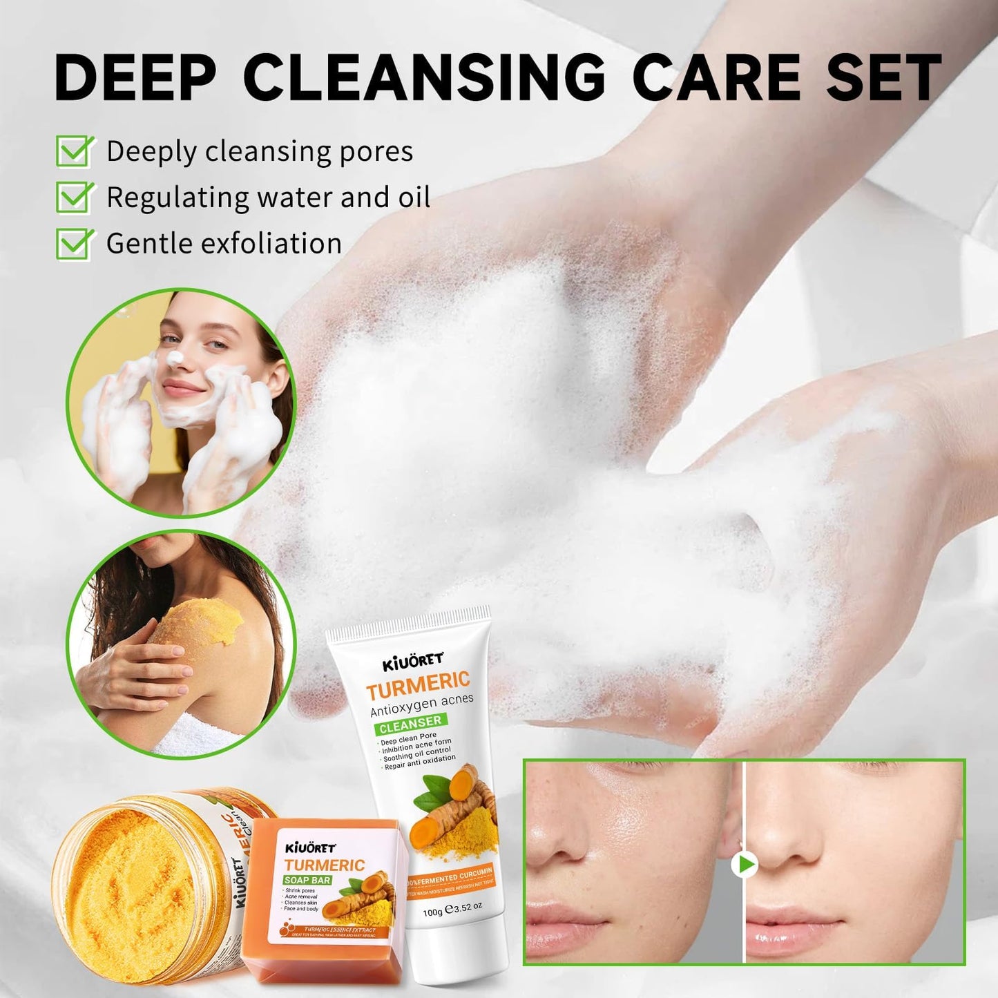 KIUORET Turmeric 11-Piece Skin Care Set | Hydration & Acne Support