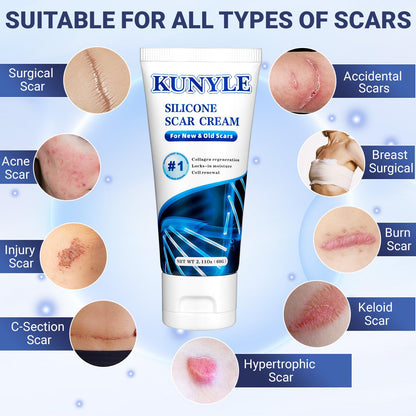 Kunyle Silicone Scar Cream - Advanced Scar Gel for Surgical Scars, Keloids, and Stretch Marks | 2.11 oz (60 g)
