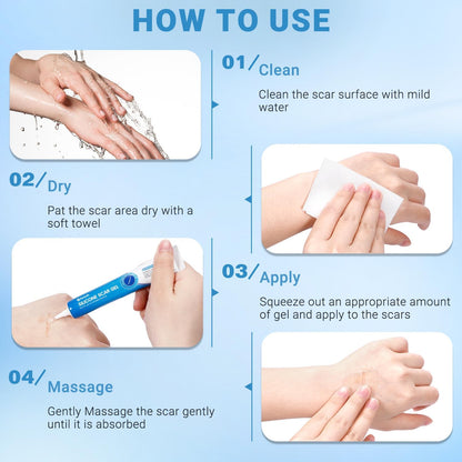Kunyle Silicone Scar Gel 0.70oz — Advanced Scar Cream for Surgical Scars, Stretch Marks & Keloids