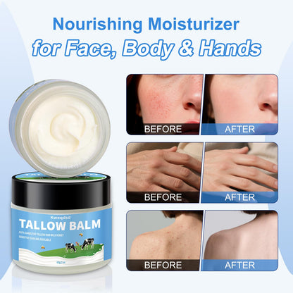Kweqdsd 5 Pack Organic Grass-Fed Beef Tallow Balm with Raw Honey | Natural Skin Moisturizer