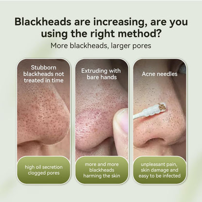 LANBENA Blackhead Mask & Nose Pore Strips — Purifying Peel-Off Mask (1.06 oz)