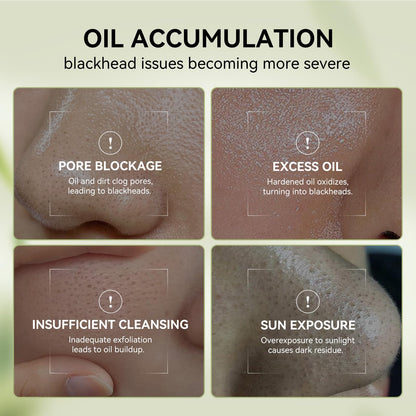 LANBENA 3-in-1 Blackhead Removal Set — Bamboo Charcoal Pore Strips, Pore Minimizing Serum & Removal Papers