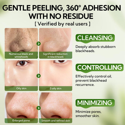 LANBENA 3.0 Bamboo Charcoal Nose Strips – Upgraded Blackhead Remover Mask