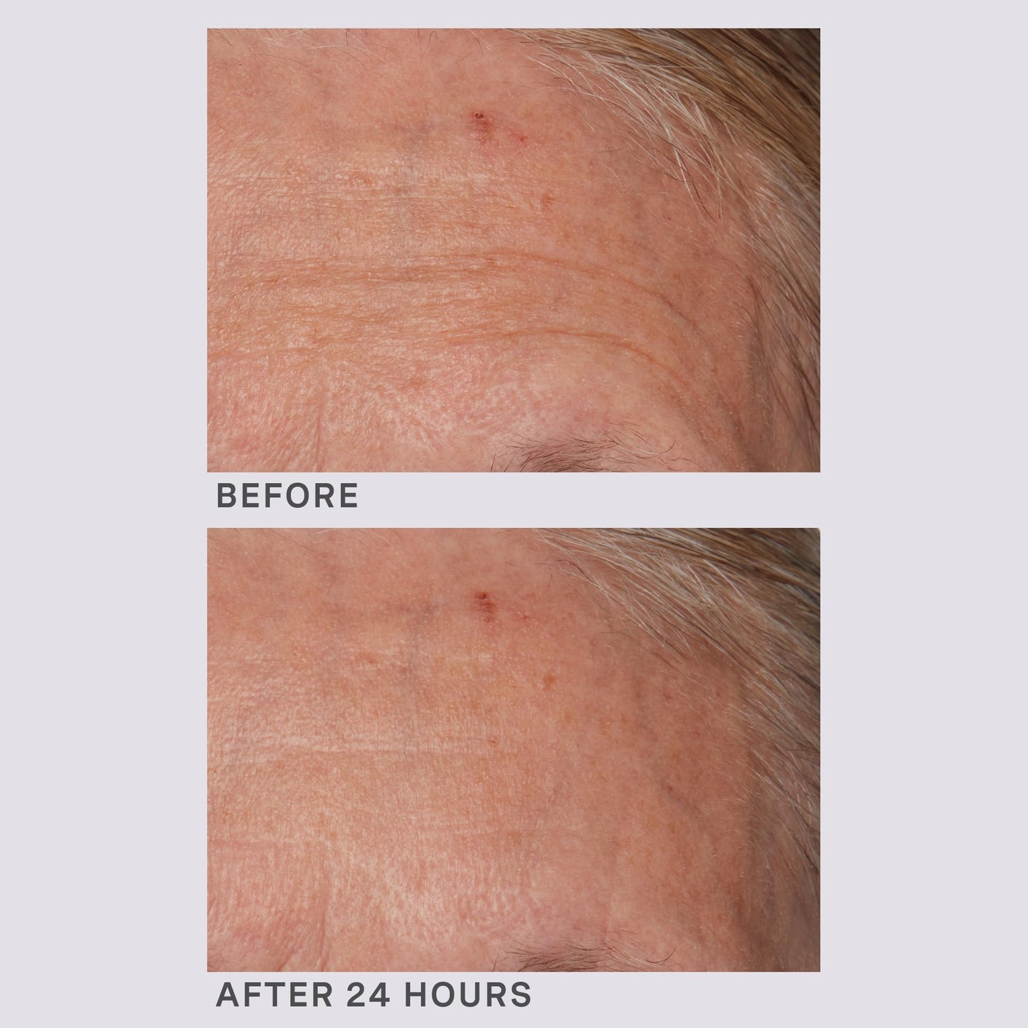 Lancer Gravity Defying Moisturizer with Firming Technology – Hydration, Elasticity & Anti-Aging