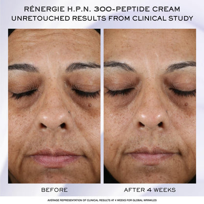 Lancôme Rénergie H.C.F. Triple Serum Discovery Set – Full-Size Serum + Mini Cream & Eye Cream