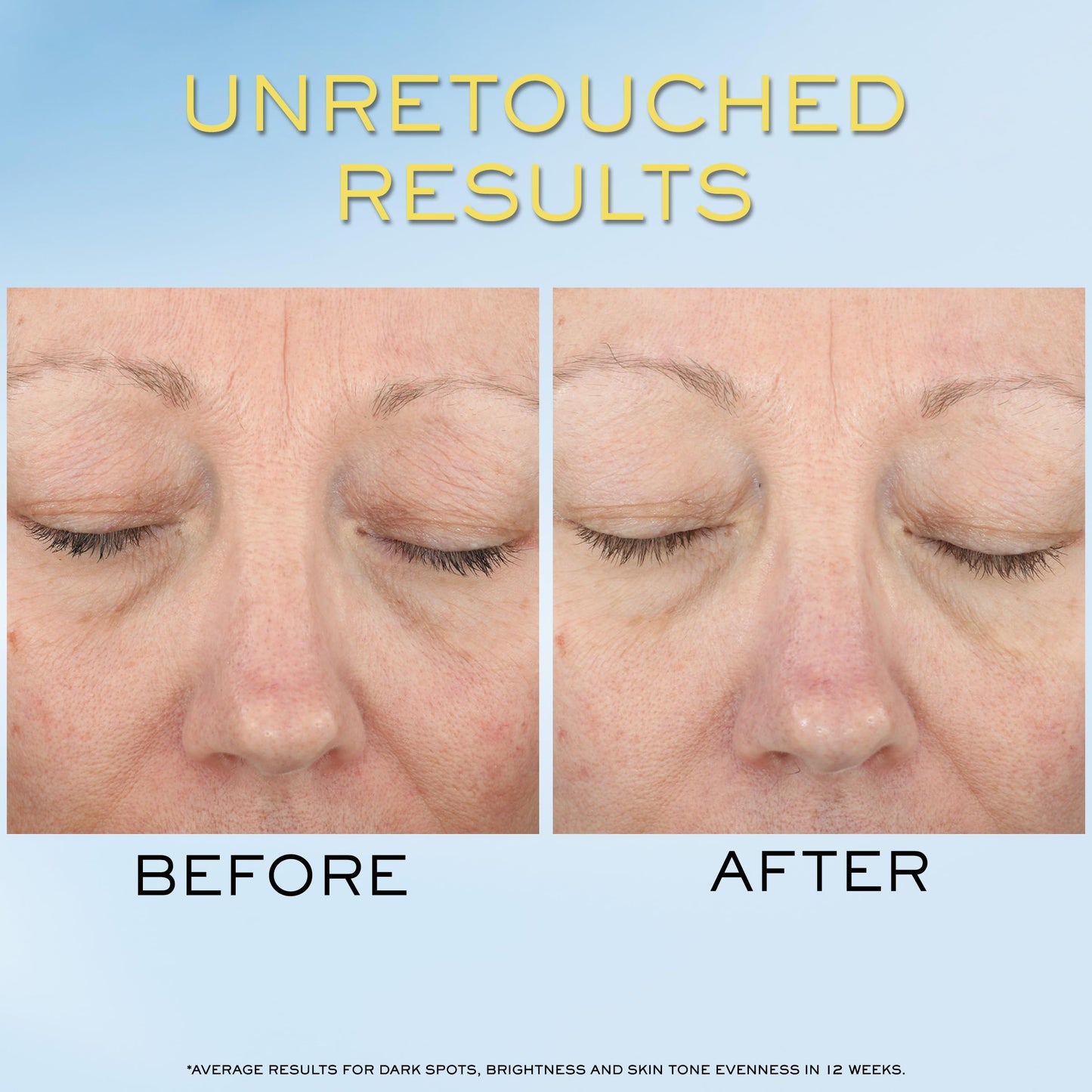 Lancôme Supra Screen Invisible Serum Sunscreen SPF 50+ – Anti-Aging Protection & Hydration