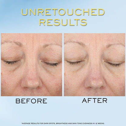 Lancôme Supra Screen Invisible Serum Sunscreen SPF 50+ – Anti-Aging Protection & Hydration