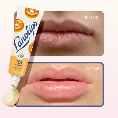 Lanolips 101 Ointment – Glazed Donut Lip Balm for Hydration & Multipurpose Care (0.52 oz)