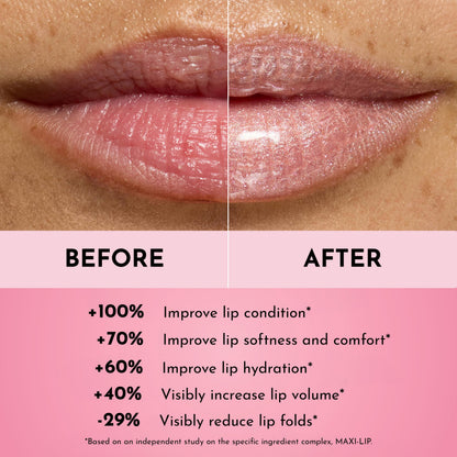 Lawless Forget the Filler Lip Plumping Gloss Candy Sky – Hydrating, Vegan, Cruelty-Free 0.11 oz
