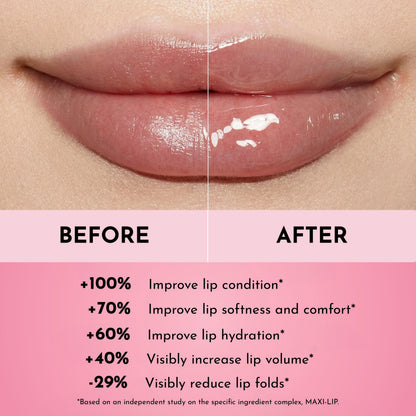 Lawless Forget The Filler Lip Plumper Line Gloss Rosy Outlook Pink 0.11 Fl Oz (Pack of 1)