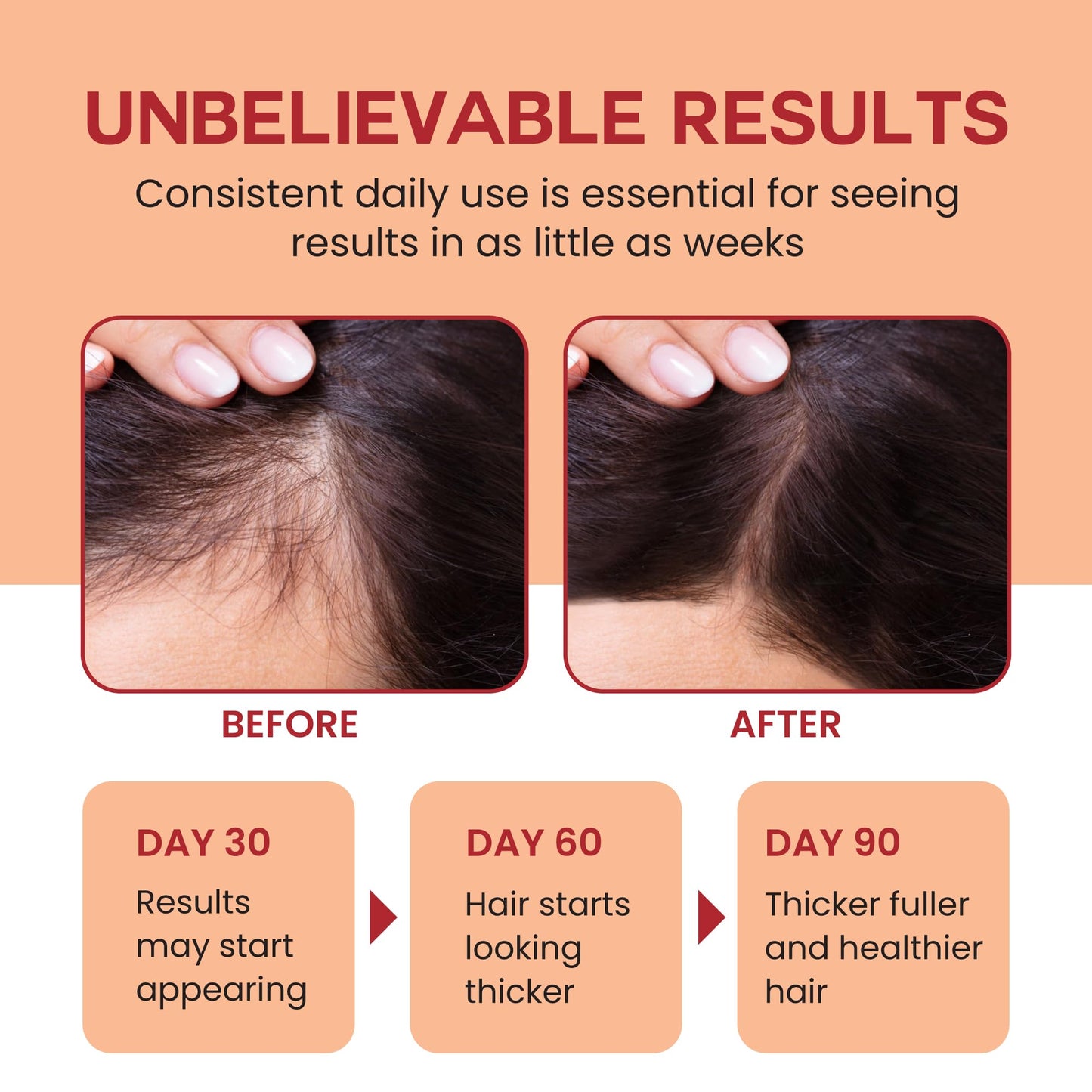 Lebanta Raw Batana Oil for Hair Growth – 100% Pure, Organic, Cold-Pressed 4oz from Honduras