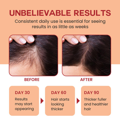 Lebanta Batana Oil for Hair Growth – 3-pack, 4oz Each, 100% Pure Organic Batana Oil from Honduras