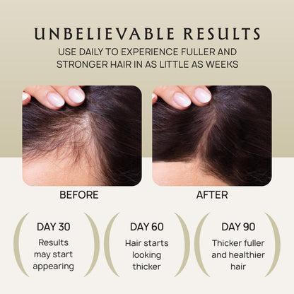 Lebanta Hair Growth Oil Spray — Organic, Non-Greasy Formula for Thicker, Stronger Hair (4 Fl Oz)