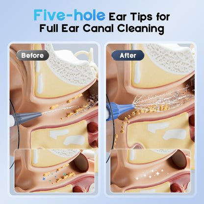 Lebbtl Ear Wax Removal Kit — Electric Ear Cleaning with Light, 4 Modes, Basin & 15 Tips