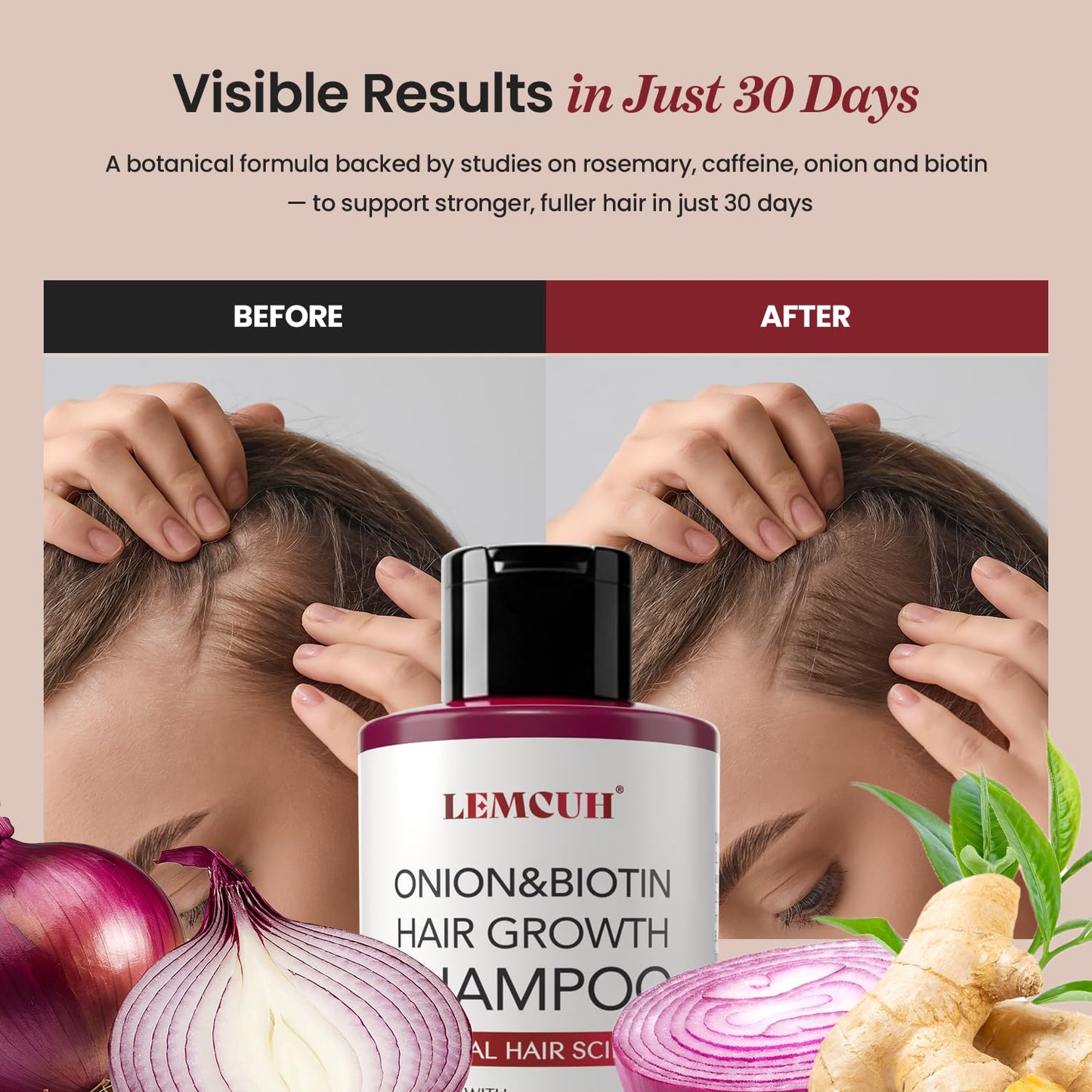Lemcuh Biotin & Onion Shampoo – Volumizing, Anti-Hair Loss, Sulfate-Free (12.5 fl oz)