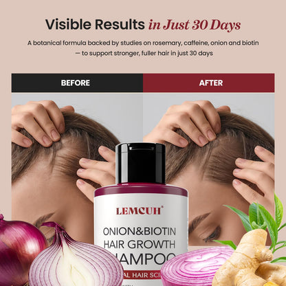 Lemcuh Rosemary Shampoo with Onion & Biotin – Volumizing Thickening Hair Care (12.5 oz)
