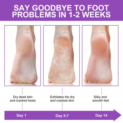 Liefiet Lavender Foot Peeling Mask 5 Pack – Exfoliate, Hydrate, Soft Feet