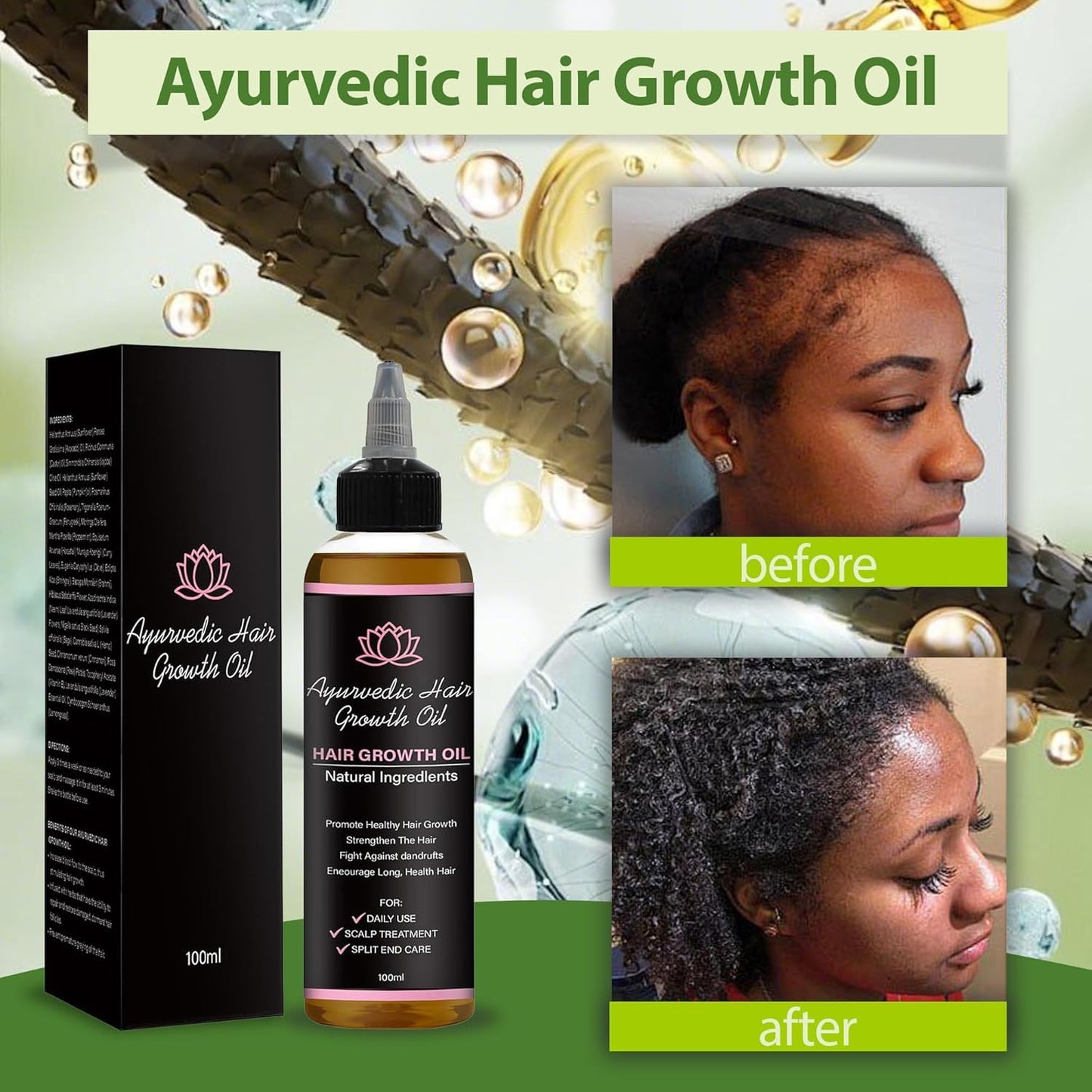 Lifewitqueenp Hair Growth Oil – Ayurvedic Scalp Oil for All Hair Types, Lightweight Herbal Formula