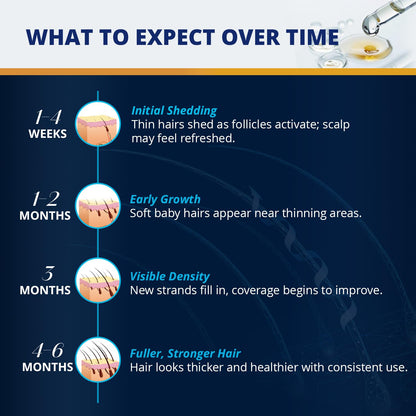 Lilivera 5% Minoxidil Hair & Beard Growth Kit – Extra Strength Topical Serum
