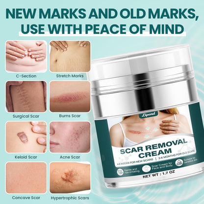 LIPEND Scar Cream Gel Silicone – 2x 1.7 oz for Scars & Burns
