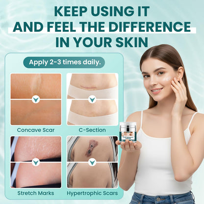 LIPEND Scar Cream Gel Silicone – 2x 1.7 oz for Scars & Burns