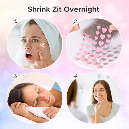 LitBear Acne Pimple Patch – 360 Dots, 3 Shapes, Salicylic Acid, Tea Tree & Calendula