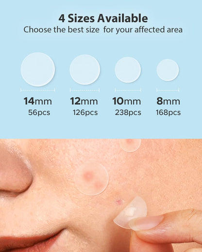 LitBear Acne Pimple Patches – Day & Night, 4 Sizes, 588 Dots