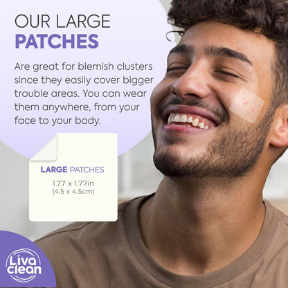 LivaClean 20CT Large Hydrocolloid Acne Patches – XL Pimple Patches for Nose & Face