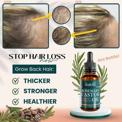 Live Fraiche Rosemary Castor Oil for Hair Growth – 4 oz, Cold-Pressed, No Fillers