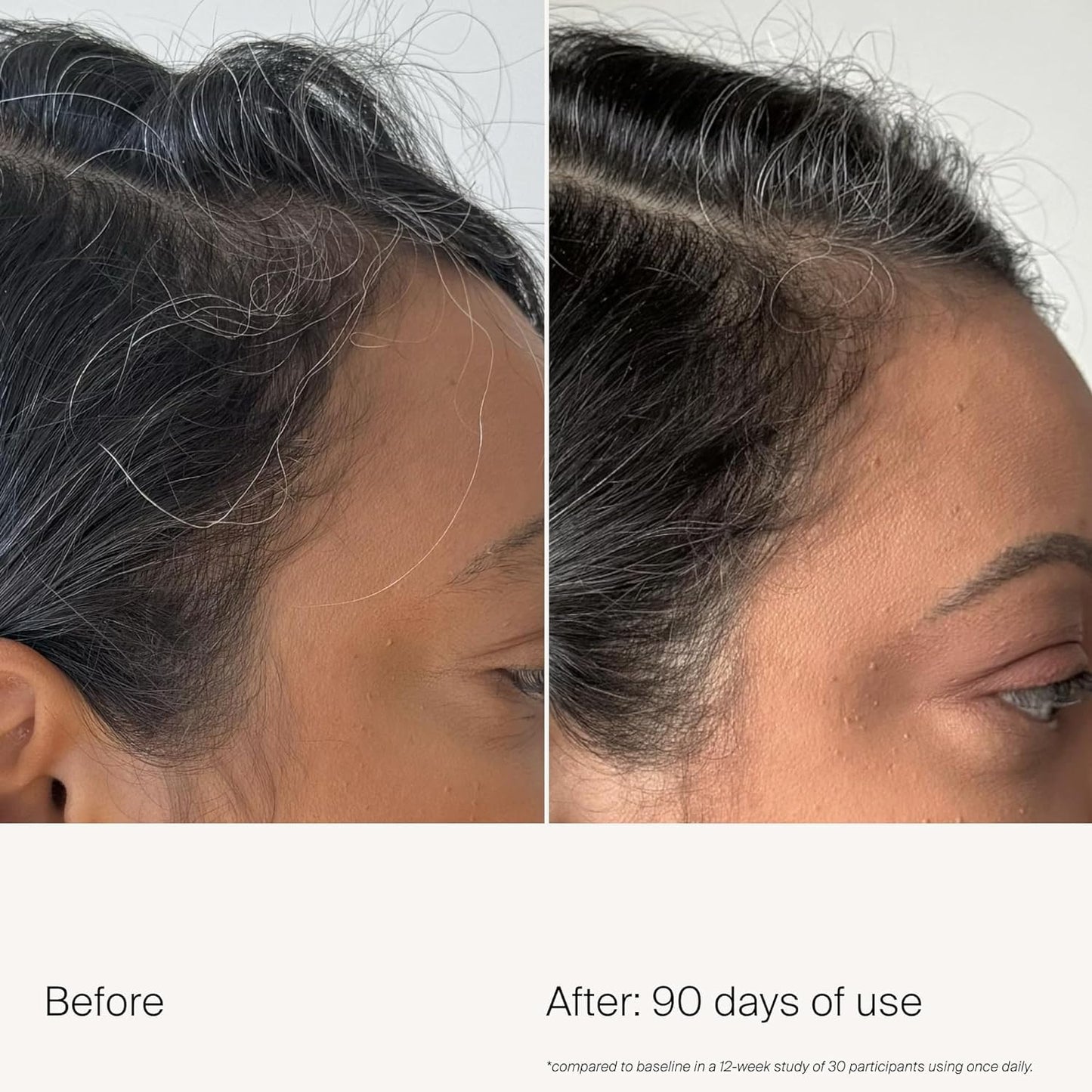 Living Proof Scalp Care Density Serum | Minimize Grey Hair, Boost Density