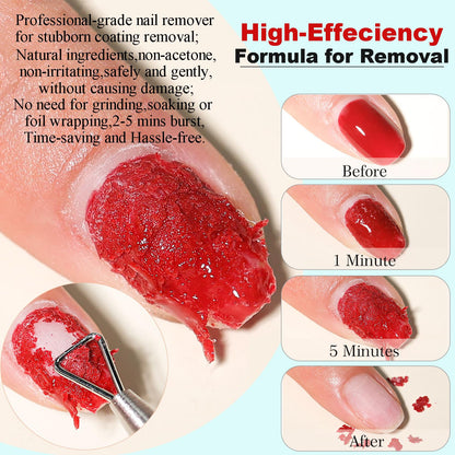 LOUINSTIC Gel Nail Polish Remover Kit — Quick, Acetone-Free Removal in 2–5 Minutes